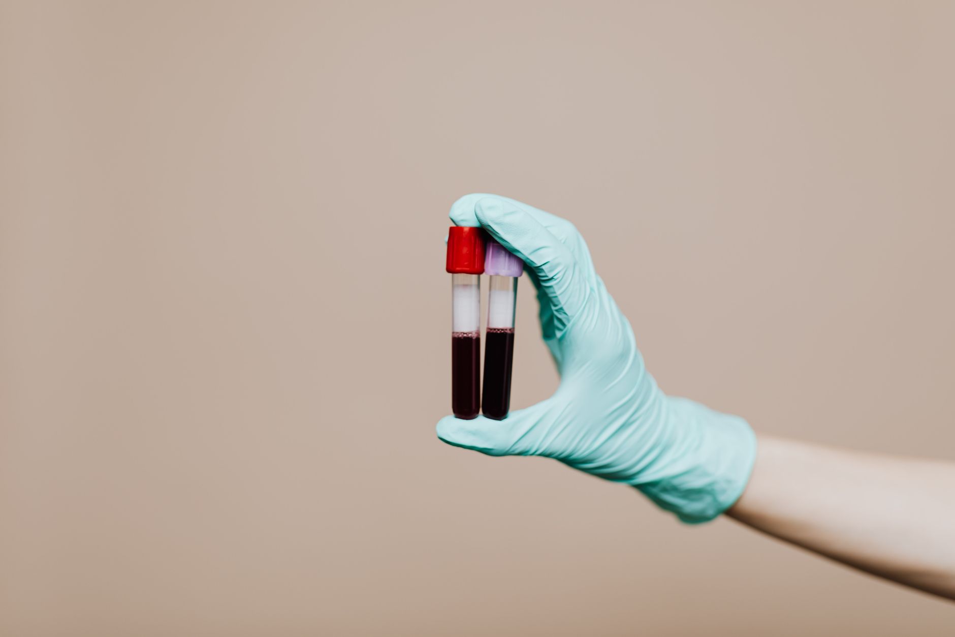 Soil Test Kit: Complete Buying and Using Guide | The Sproutstead